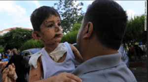 Gazan boy hit by strikes going to the hospital on July 20