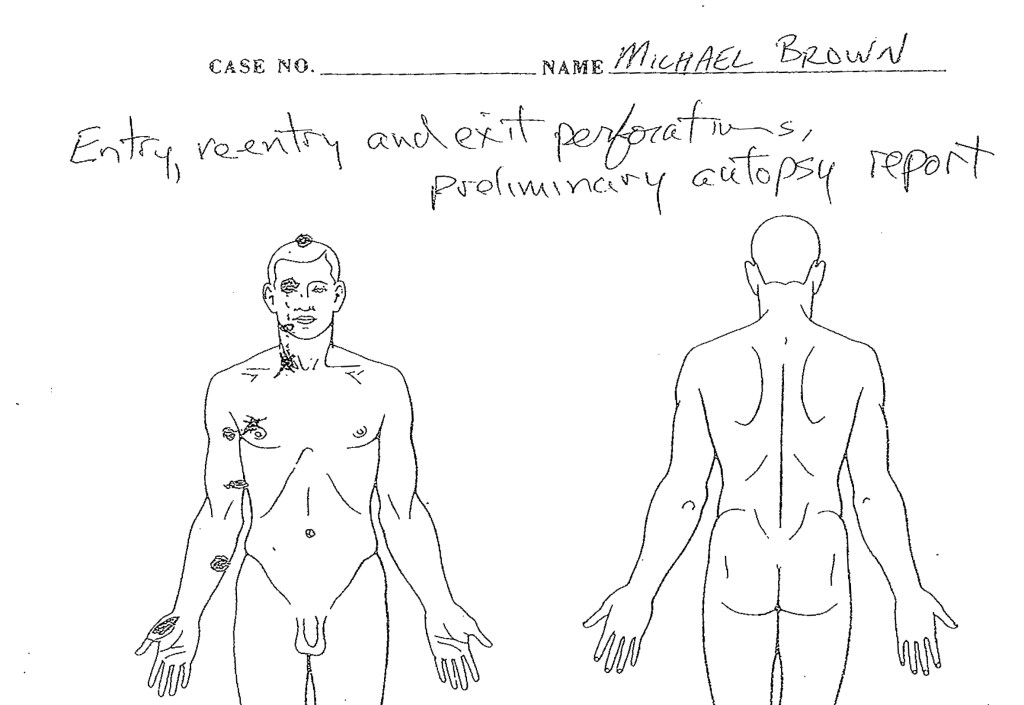 autopsycrop via Dr. Michael Baden
